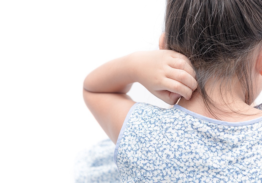 小児のアレルギー